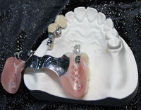 CCP Framework Metal 3d Printing PFM Denture And False Teeth