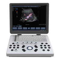 Laptop Color Doppler Ultrasound Scanner BENE-3S with 15 Inch LCD Screen & 3 Probe Connector