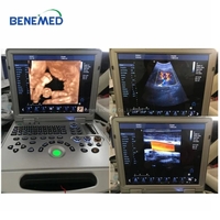Bene-3PRO Medical Portable 4D Color Doppler Ultrasound Scanner