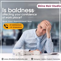 Shine Hair Studio | Hair Replacement | Wig Dealers |Hair Extensions | Wig