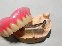 Product Tags: OEM Denture Dental Lab 3D Digital Denture Dental lab Digital Dental Models