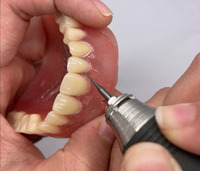 Dental Crown Porcelain Fused Metal,PFM,Dental Prothesis Laboratoire Dentaire,Dentallabor,Dental Lab