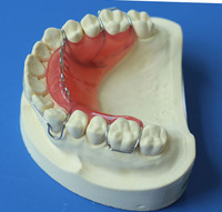 more images of Titanium Denture Crown 3D Printing Denture Metal Titanium Teeth