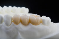 more images of Mouth Guard | Outsourcing Chinese Dental Lab