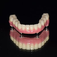 more images of Mouth Guard | Outsourcing Chinese Dental Lab