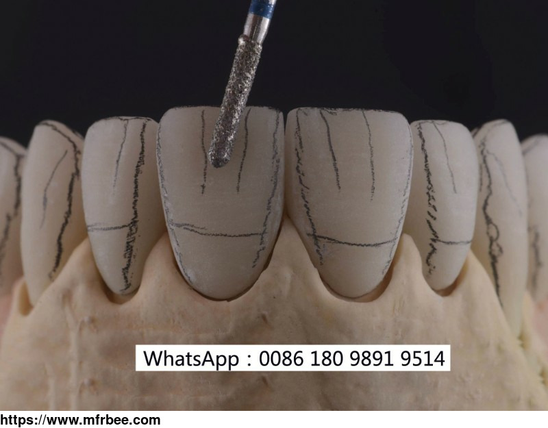 porcelain_fused_to_metal_pfm_dental_crowns_and_bridges_chinese_full_service_dental_lab_looks_for_cooperation