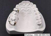 Orthodontic-Appliance Zirconia Dental Lab in China