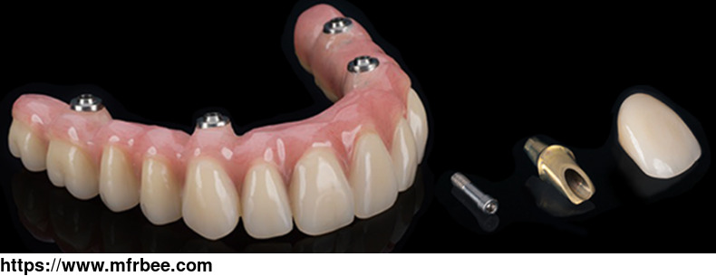 smart_1_abutments_by_myy_dental_lab