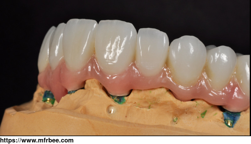 denture_over_implant_bars_china_dental_laboratory_china_digital_dental_lab