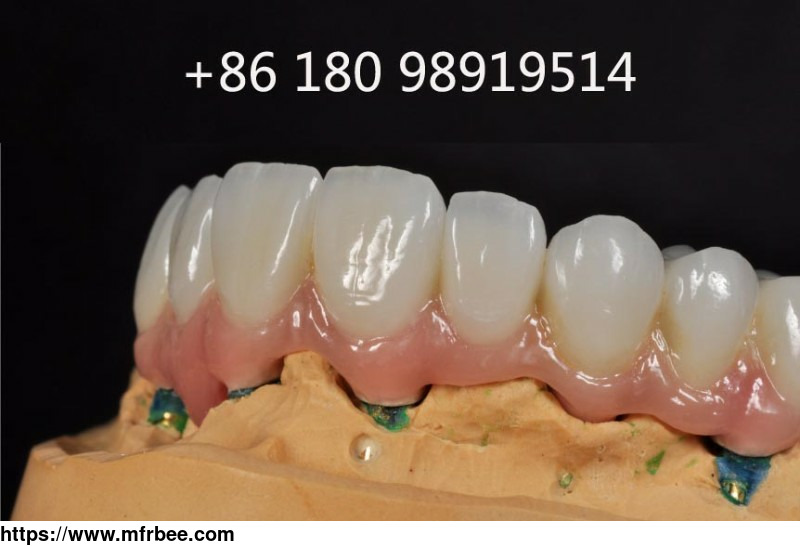 myy_for_implant_restorations_chinese_dental_laboratory