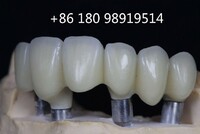 more images of MYY for Implant Restorations Chinese Dental Laboratory