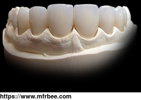 veneers_w_e_max_fda_certificated_chinese_dental_lab_looks_for_usa_distributors