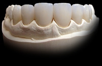 more images of Veneers w/E.max  FDA certificated Chinese dental lab looks for USA distributors