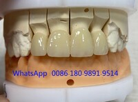 Full zirconia restoration fabricated by  China Dental LabZIRMAX Key Features