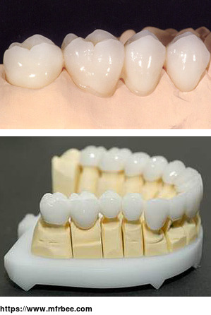 ips_e_max_ips_e_max_veneer_crown_dental_lab_manufacturers_suppliers