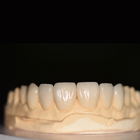more images of Diagnostic Wax-Ups china outsourcing dental lab