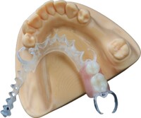 more images of Valplast Flexible Partials China Dental Lab | Official Website | Outsourcing Service