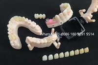 China - Invisible Orthodontics