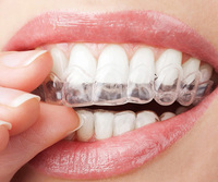 more images of MYY Aligners / Invisible Retainers