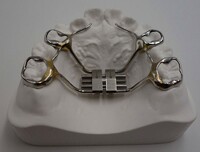 more images of Invisible Orthodontic Mouth Guard From China Dental Lab
