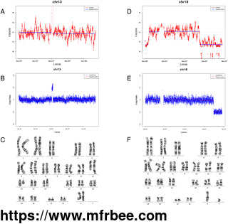 performance_evaluation_of_nipt_in_detection_of_chromosomal_copy_number_variants_using_low_coverage_whole_genome_sequencing_of_plasma_dna