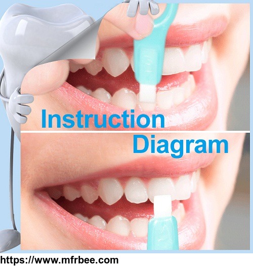 dental_disposable_products_white_smile_teeth_whitening_kit