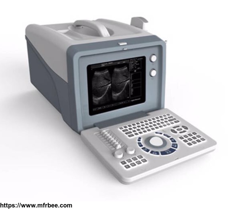 portable_black_and_white_ultrasound_scanner_bw_3_with_10_inch_crt_screen_and_two_probe_connector