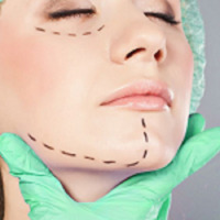 more images of Laser Hair Removal