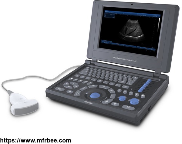 canyearn_a10_full_digital_laptop_ultrasound_scanner