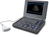 Canyearn A10 Full Digital Laptop Ultrasound Scanner