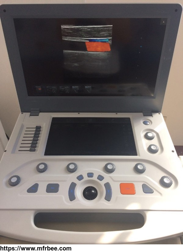 canyearn_c95_portable_color_doppler_ultrasound_scanner_with_touch_screen