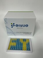 Mouse IgE(Immunoglobulin E) ELISA Kit