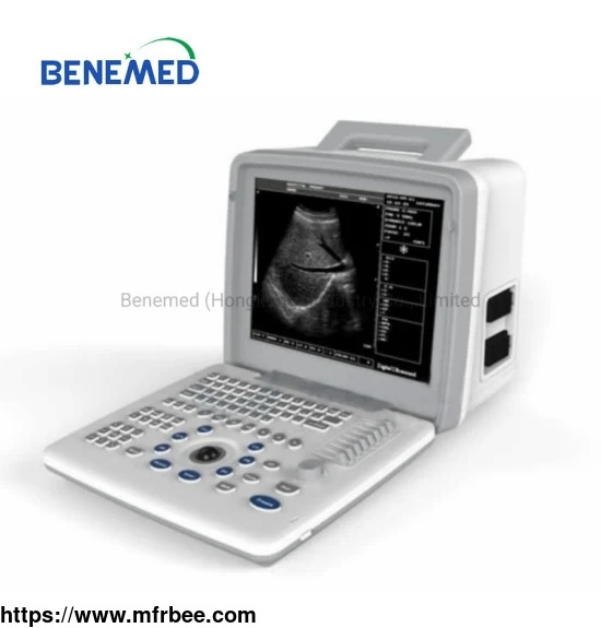 portable_b_w_ultrasound_scanner_with_clear_image_quality