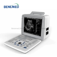 more images of Portable B/W Ultrasound Scanner with Clear Image Quality