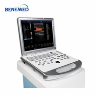 Hospital 3D 4D Color Doppler Ultrasound Scanner Portable