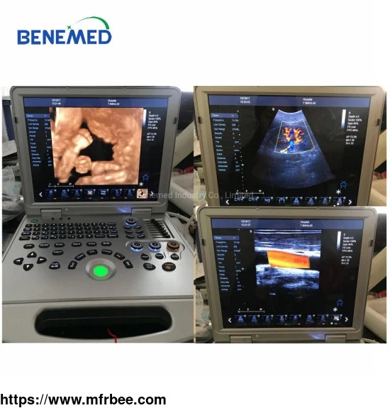 bene_3pro_medical_portable_4d_color_doppler_ultrasound_scanner