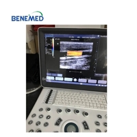 Laptop Type Color Doppler Ultrasound Scanner Clear Qualtiy Image