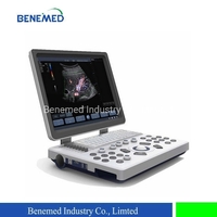 more images of Laptop Type Color Doppler Ultrasound Scanner Clear Qualtiy Image
