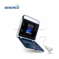Bm-60c Opu Vet Ultrasound Scanner Color Doppler Portable