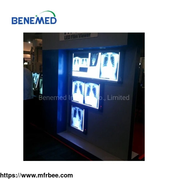 ultra_slim_led_medical_x_ray_film_viewer_double_section