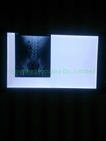 more images of Ultra Slim LED Medical X-ray Film Viewer Double Section