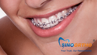 more images of Self-Ligating Brackets In Orthodontics