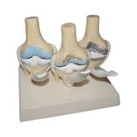 Human Knee Joint and Skeletal Anatomical Teaching Model