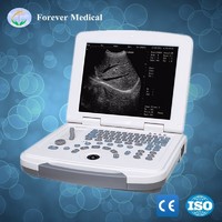YJ-U500 W2.0 Version Full-Digital Ultrasound Scanner Especificación técnica