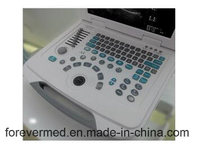 more images of YJ-U500 W2.0 Version Full-Digital Ultrasound Scanner Especificación técnica