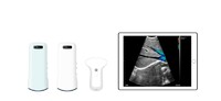 more images of Abdomen Ultrasound Convex Probes