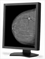 NEC 21 Inch Grayscale 5-Megapixel Medical Diagnostic Monitor MD215MG-S5