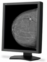 NEC 21 Inch Grayscale 5-Megapixel Medical Diagnostic Monitor MD215MG