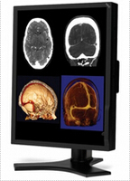 more images of NEC 21 Inch Color 2-Megapixel Medical Diagnostic Monitor MD212MC