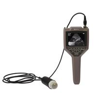 Portable Handheld Ultrasound Scanner